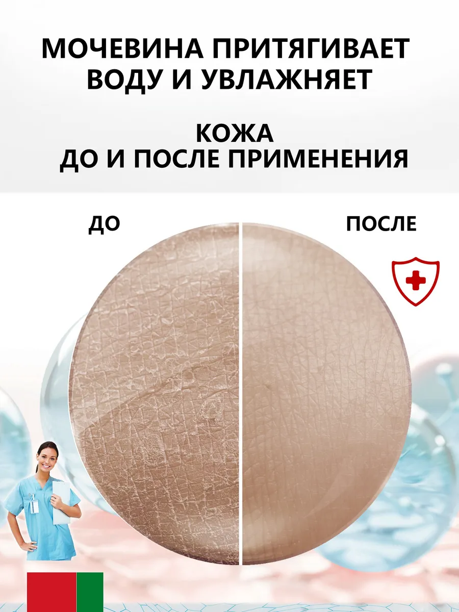Крем с мочевиной 10% + ионы серебра, 170 мл — изображение 2