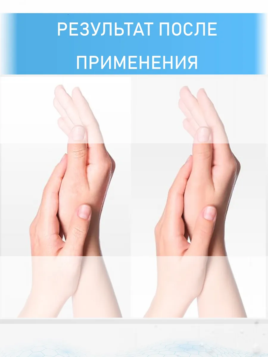 Крем с мочевиной 15% + ионы серебра, 170 мл — изображение 4