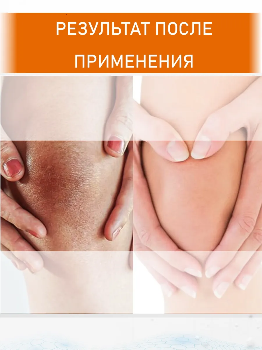 Крем с мочевиной 25 + ионы серебра 170 мл