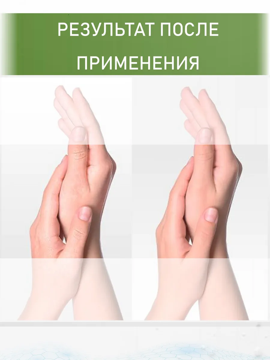 Крем с мочевиной 10% + ионы серебра, 170 мл