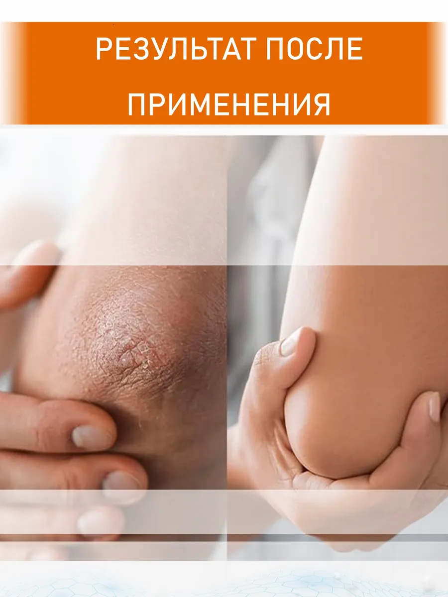 Крем с мочевиной 25 + ионы серебра 170 мл