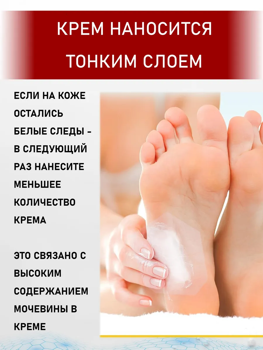 Крем с мочевиной 35 + ионы серебра 170 мл